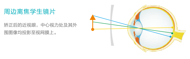 雙11（10）